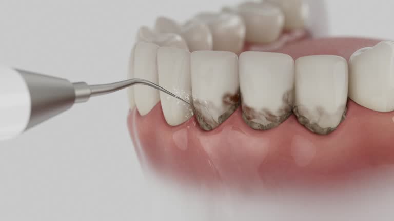 Trusted Emergency Dentist service in East Lexington, VA - Dentist Open Now